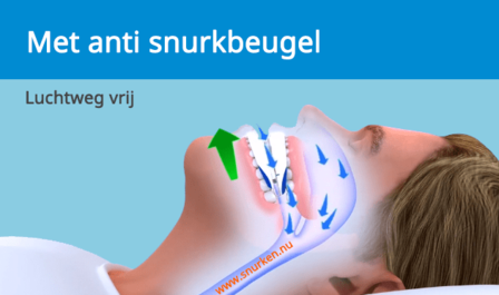 SomnoGuard AP2 snurkbeugel